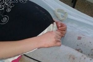 Menino de 9 anos atinge m&atilde;e gr&aacute;vida com pedrada em Campo Grande