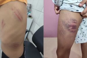 Investiga&ccedil;&atilde;o inocenta m&atilde;e e filho acusados de espancar estudante autista em Campo Grande