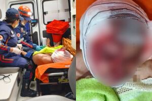 Idoso &eacute; atacado por cachorro e sofre m&uacute;ltiplas lacera&ccedil;&otilde;es no rosto em Aquidauana