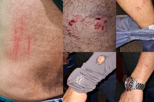 Agente de sa&uacute;de &eacute; atacado por pitbull em Ribas do Rio Pardo