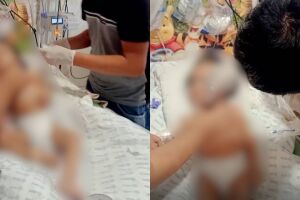 Beb&ecirc; completa 40 dias internada e com traqueostomia precisa de aspirador de secre&ccedil;&atilde;o (v&iacute;deo)