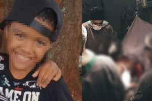 Santa Casa usa pele doada como 'curativo biol&oacute;gico' em menino com queimaduras graves (v&iacute;deo)