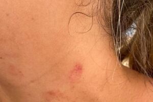Mulher &eacute; arrastada pelos cabelos, tem pesco&ccedil;o pisado e desmaia durante agress&atilde;o em Dourados