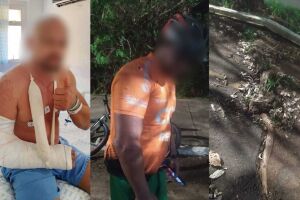 Ciclista cai em ciclovia sem manuten&ccedil;&atilde;o e enfrenta falta de medicamentos na Santa Casa 