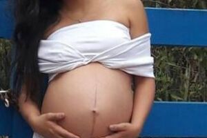 Bebê entra em sofrimento fetal após adolescente entrar na 42ª semana e médico não avisar