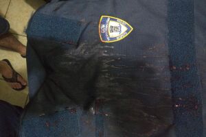 Guarda municipal atacado ao realizar abordagem levou de 10 a 15 golpes de faca