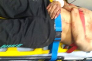 Homem é perseguido e fica ferido ao sofrer queda de quatro metros de altura