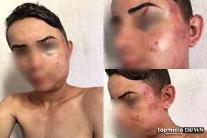 O jovem publicou fotos de como ficou seu rosto após ser espancado.