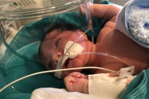 Bebê enterrada viva pela avó está em estado grave em UTI