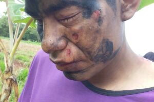 Cerca de 10 índios ficam feridos em ataque a acampamento; fazendeiros negam autoria