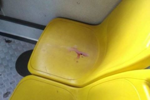 Mancha de sangue em banco de ônibus gera polêmica sobre tabu da menstruação