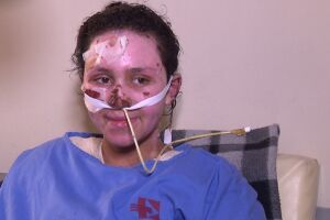 Menina que teve 60% do corpo queimado ao salvar irmão de incêndio morre no hospital