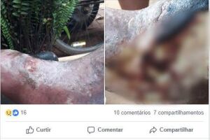 Sem atendimento da prefeitura, hanseníase consome paciente em cidade do MS