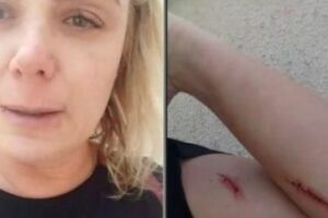Após acusar marido de agressão, imagens mostram ex-paquita se automutilando