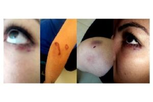 Mulher acusa companheiro de agressão e pede medida protetiva