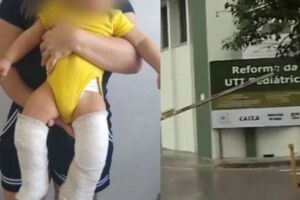 Padrasto é preso por quebrar duas pernas de bebê; mãe achou que criança tinha ‘ossos de vidro’