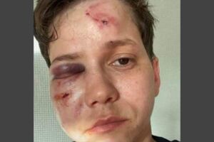 Youtuber Karol Eller &eacute; v&iacute;tima de ataque no RJ