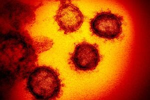 Segundo caso de novo coronavírus no Brasil é confirmado em São Paulo