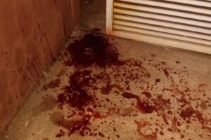 Mulher é agredida com facão e quase tem mãos arrancadas por ex-marido