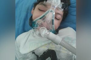 João Arthur tem microcefalia e mãe pede ajuda com remédios de crises convulsivas e respiratórias