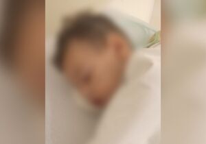 Pequi 'explode' em criança e menino passa por cirurgia; mãe faz alerta