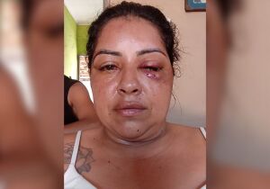 Mulher é espancada, estuprada e mantida em cárcere pelo namorado no Jardim Noroeste (vídeo)