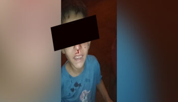 Menino é espancado e mãe acusa madrasta em Ribas: 'quero essa monstra na cadeia' (vídeo)