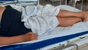 Paciente 'internada' em UPA com dor intensa é transferida para a Santa Casa