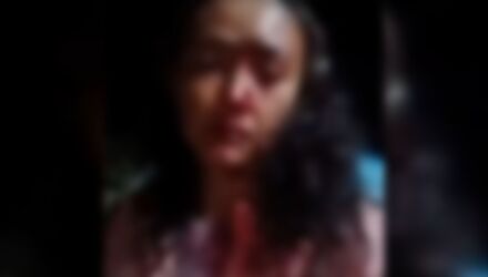 V&iacute;tima chegou a desmaiar ap&oacute;s receber soco e hoje apresenta convuls&otilde;es como sequela da agress&atilde;o