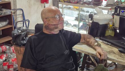 V&iacute;tima de 72 anos levou 12 pontos, principalmente na cabe&ccedil;a e no pesco&ccedil;o; suspeito, de 37 anos, tamb&eacute;m ficou ferido e foi levado &agrave; Santa Casa sob escolta policial