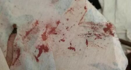 Vítima estava visivelmente embriagada quando foi socorrida