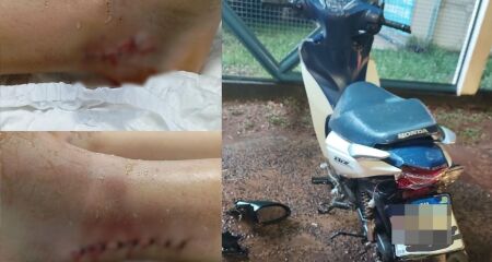Uma das vítimas quase não teve ferimentos enquanto a outra passou por cirurgia nos pés