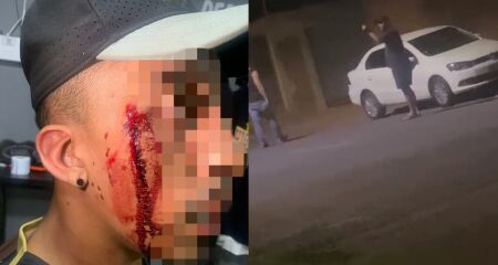 Barbeiro teve rosto cortado por policial de folga 