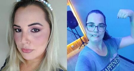 Mariana Michelini perdeu os lábios e parte do queixo após um preenchimento feito em dezembro de 2020, no interior de São Paulo