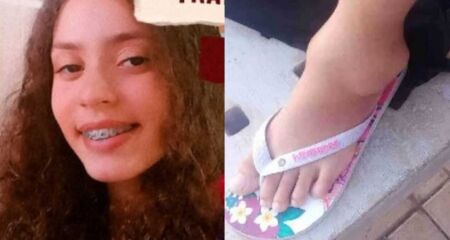 Aos 15 anos, Emelly Eduarda sofre com Sarcoma Sinovial Fusocelular Monofásico no tornozelo esquerdo