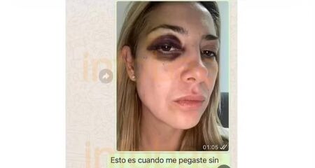 Fabiola Yañez diz ter sido agredida por 3 dias seguidos pelo ex-presidente Alberto Fernández; caso foi denunciado à Justiça argentina