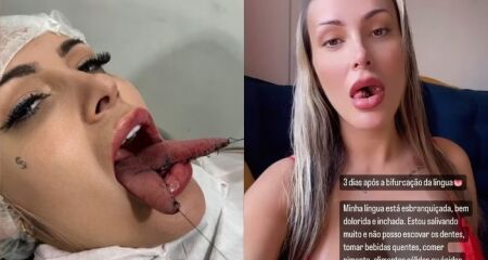 A criadora de conteúdo adulto revelou que está com "bastante" dor em um vídeo ao som de Puta Cara, da Anitta
