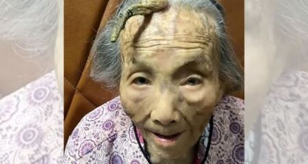 Muitas pessoas acreditam que o chifre da chinesa Chen, de 107 anos, é o segredo por trás de sua longevidade; entenda
