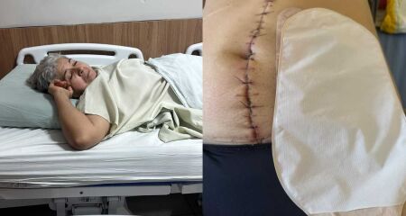 Sebastiana Maria fez cirurgia de emergência com médico de outro estado e precisa retornar para reversão com o mesmo