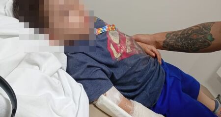 Menino de 6 anos teve dedo decepado na porta do banheiro da Escola Classe 415 de Samambaia. O acidente aconteceu em 12 de março