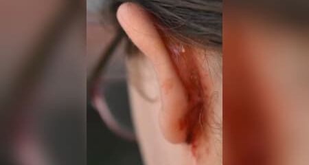 Vítima registrou boletim de ocorrência e pediu medidas protetivas contra o agressor