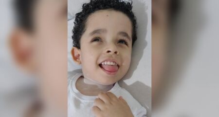 Miguel, de 5 anos, vive com hidrocefalia e paralisia cerebral