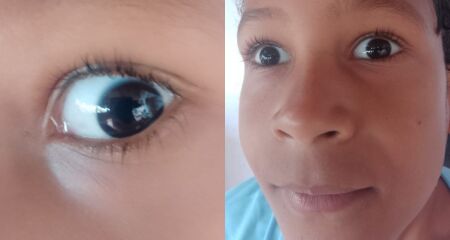 Mãe relata que filho quase não enxerga e sofre na escola; família pede ajuda