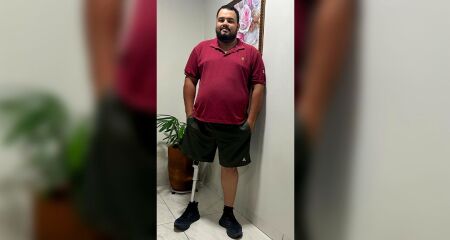 Anderson Carlos Berti amputou a perna aos 13 anos; prótese atual está velha e incômoda