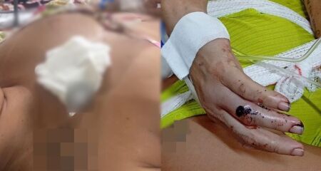 Paciente está na enfermaria