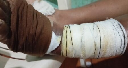 Maria Gina chegou a fazer tratamento particular por um tempo, mas precisou voltar a tratar pelo SUS devido à falta de dinheiro