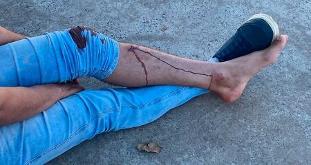 Ele ficou no local aguardando o socorro, sentado no chão