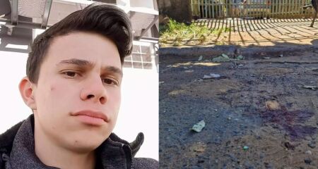 Desde sua internação, Valmir já passou por três cirurgias e fez uma raspagem no braço