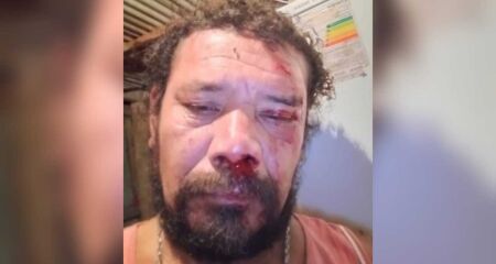 Morador relata momento de terror e revela que já perdeu quatro cães em ataques anteriores