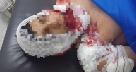 Rapaz levou um tiro do irmão da namorada com quem tinha uma desavença